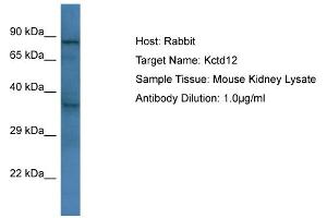 Host: Rabbit Target Name: Kctd12 Sample Type: Mouse Kidney lysates Antibody Dilution: 1.