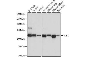 Western blot analysis of extracts of various cell lines, using MIB1 antibody. (MIB1 anticorps  (AA 560-860))