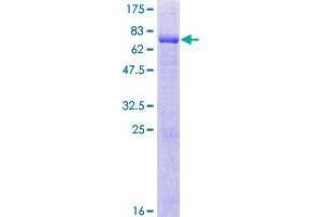 Image no. 1 for Bardet-Biedl Syndrome 5 (BBS5) (AA 1-341) protein (GST tag) (ABIN1346475)