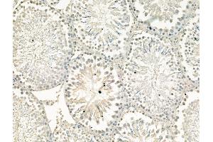 ABIN7094493 and ABIN7098542 at 1/100 staining Rat testis tissue by IHC-P.