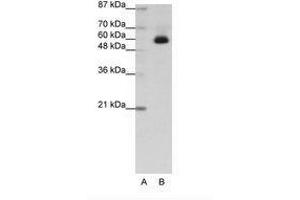 Image no. 1 for anti-Zinc Finger Protein 307 (ZKSCAN4) (C-Term) antibody (ABIN202741) (ZKSCAN4 anticorps  (C-Term))