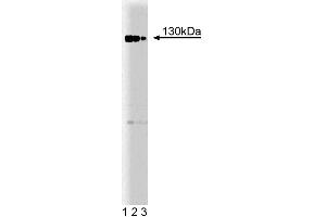 Western blot analysis of Rb2 on a Jurkat cell lysate. (p130 anticorps  (AA 26-367))