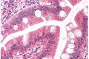 anti-Embigin (EMB) (C-Term) antibody