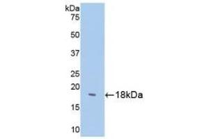 Detection of Recombinant SST, Human using Polyclonal Antibody to Somatostatin (SST)