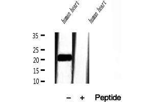 Western blot analysis of extracts of human heart tissue, using Transgelin 2 antibody.
