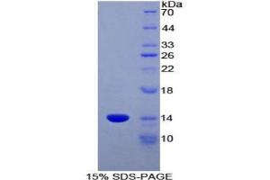 SDS-PAGE analysis of Rat CCL6 Protein.