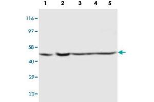 Western blot analysis of tissue and whole cell extracts with PSEN2 polyclonal antibody . (Presenilin 2 anticorps  (Internal Region))