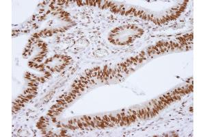 Immunohistochemistry (IHC) image for anti-Histone Deacetylase 1 (HDAC1) (C-Term) antibody (ABIN7448972)