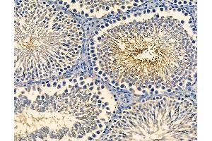anti-F-Box Protein 38 (FBXO38) antibody