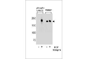Western blot analysis of extracts from A431 cells,untreated or treated with EGF,100 ng/mL,using phospho ERBB2  (left) or ERBB2 Antibody (right) (ErbB2/Her2 anticorps  (pTyr1196))