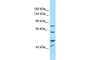 Western Blotting (WB) image for anti-Microcephalin 1 (MCPH1) (C-Term) antibody (ABIN2789648) (MCPH1 anticorps  (C-Term))