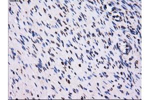 Immunohistochemical staining of paraffin-embedded Ovary tissue using anti-PPME1mouse monoclonal antibody. (PPME1 anticorps)