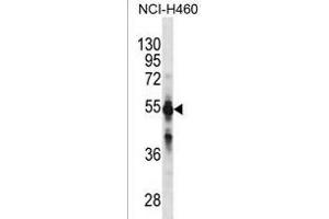 CYP2C9 Antibody (N-term)(Ascites) ABIN1882233 western blot analysis in NCI- cell line lysates (35 μg/lane). (CYP2C9 anticorps  (N-Term))