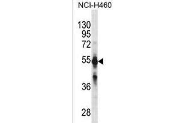 CYP2C9 anticorps  (N-Term)