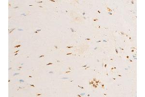 ABIN6267286 at 1/100 staining human heart tissue sections by IHC-P.