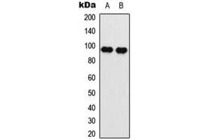 Western blot analysis of EEF2 (pT56) expression in SKOV3 (A), NIH3T3 (B) whole cell lysates.