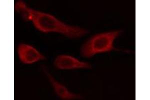 ABIN6274645 staining HT29 cells by IF/ICC. (CYP2B6 anticorps  (Internal Region))