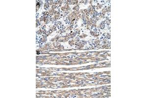 Immunohistochemical staining (Formalin-fixed paraffin-embedded sections) of human liver (A) and human heart (B) with DLX5 polyclonal antibody  at 4-8 ug/mL working concentration. (DLX5 anticorps  (N-Term))