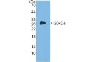 Detection of Recombinant Flt3, Mouse using Polyclonal Antibody to FMS Like Tyrosine Kinase 3 (Flt3) (FLT3 anticorps  (AA 335-544))