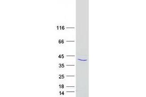 Validation with Western Blot