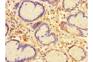 Immunohistochemistry of paraffin-embedded human stomach tissue using ABIN7146737 at dilution of 1:100 (CA11 anticorps  (AA 24-328))