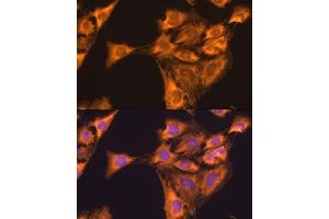 Immunofluorescence analysis of C6 cells using RPL23 antibody (ABIN1682575, ABIN5664722, ABIN5664724 and ABIN6220574) at dilution of 1:100.