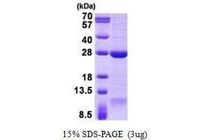 Figure annotation denotes ug of protein loaded and % gel used. (DNAL1 Protéine)