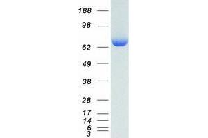 Lysyl-tRNA Synthetase (KARS) (Transcript Variant 2) protein (Myc-DYKDDDDK Tag)