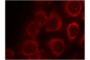 Image no. 1 for anti-SMAD, Mothers Against DPP Homolog 1 (SMAD1) (AA 461-465) antibody (ABIN319351) (SMAD1 anticorps  (AA 461-465))