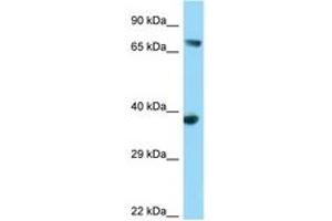 Image no. 1 for anti-FYN-Binding Protein (FYB) (AA 39-88) antibody (ABIN6748114) (FYB anticorps  (AA 39-88))