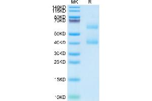 Matrix Extracellular phosphoglycoprotein (MEPE) (AA 25-441) protein (His tag)