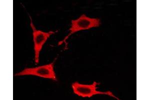 ABIN6267259 staining BT-20 cells by ICC/IF. (EGFR anticorps  (pThr693))