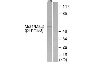 Western blot analysis of extracts from 293 cells, treated with H2O2 (100uM, 15 mins), using Mst1/2 (Phospho-Thr183) antibody. (MST1/MST2 (pThr183) anticorps)