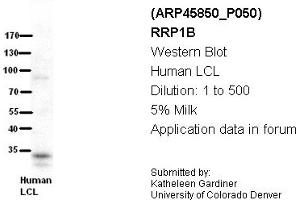 Image no. 2 for anti-Ribosomal RNA Processing 1 Homolog B (RRP1B) (Middle Region) antibody (ABIN2782382) (RRP1B anticorps  (Middle Region))