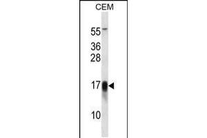 Western blot analysis in CEM cell line lysates (35ug/lane). (FXYD5 anticorps  (AA 71-100))