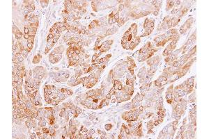 IHC-P Image Immunohistochemical analysis of paraffin-embedded SCC4 xenograft, using PEF1, antibody at 1:100 dilution. (PEF1 anticorps)