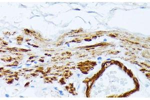 Immunohistochemistry of paraffin-embedded Human stomach using TPM2 Polyclonal Antibody at dilution of 1:100 (40x lens). (TPM2 anticorps)