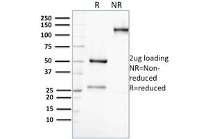 SDS-PAGE Analysis Purified AKR1C2 Mouse Monoclonal Antibody (CPTC-AKR1C2-1).