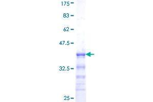 Image no. 1 for SRY (Sex Determining Region Y)-Box 10 (SOX10) (AA 336-433) protein (GST tag) (ABIN1320980)
