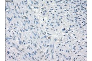 Image no. 4 for anti-Fc Fragment of IgG, Low Affinity IIa, Receptor (CD32) (FCGR2A) antibody (ABIN1497263)