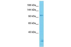 Host: Rabbit Target Name: CCDC132 Sample Type: ACHN Whole cell lysates Antibody Dilution: 1. (Syndetin/VPS50 anticorps  (N-Term))