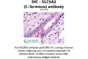 Image no. 1 for anti-Solute Carrier Family 5 (Sodium/glucose Cotransporter), Member 2 (SLC5A2) (C-Term) antibody (ABIN1739396) (SLC5A2 anticorps  (C-Term))