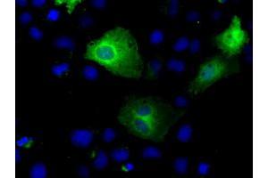 Immunofluorescence (IF) image for anti-Tubulin tyrosine Ligase-Like Family, Member 12 (TTLL12) antibody (ABIN1499032) (TTLL12 anticorps)
