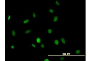 Immunofluorescence of monoclonal antibody to HDAC1 on HeLa cell. (HDAC1 anticorps  (AA 1-482))