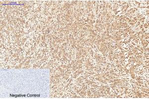 anti-X-Ray Repair Complementing Defective Repair in Chinese Hamster Cells 4 (XRCC4) antibody