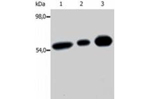 Immunoprecipitation of FYN from the lysate of T cells isolated from fresh buffy coats. (FYN anticorps  (AA 7-176))