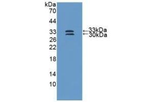 Detection of Recombinant SOD3, Human using Polyclonal Antibody to Superoxide Dismutase 3, Extracellular (SOD3)