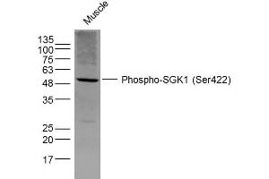 Mouse Muscle lysates probed with SGK1 (Ser422) Polyclonal Antibody, Unconjugated  at 1:300 dilution and 4˚C overnight incubation. (SGK1 anticorps  (pSer422))