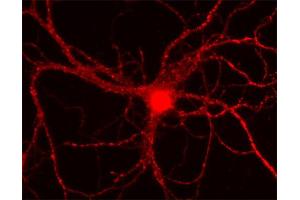 Indirect immunostaining of rat hippocampus neurons (dilution 1 : 500).