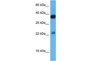 Host:  Mouse  Target Name:  CREB1  Sample Tissue:  Mouse Kidney  Antibody Dilution:  1ug/ml (CREM anticorps  (C-Term))